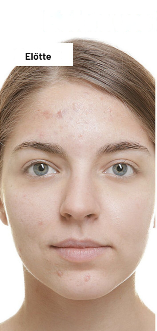 Sauvasine™ kojsav szérum – Világosító és Pigmentfolt-csökkentő szérum