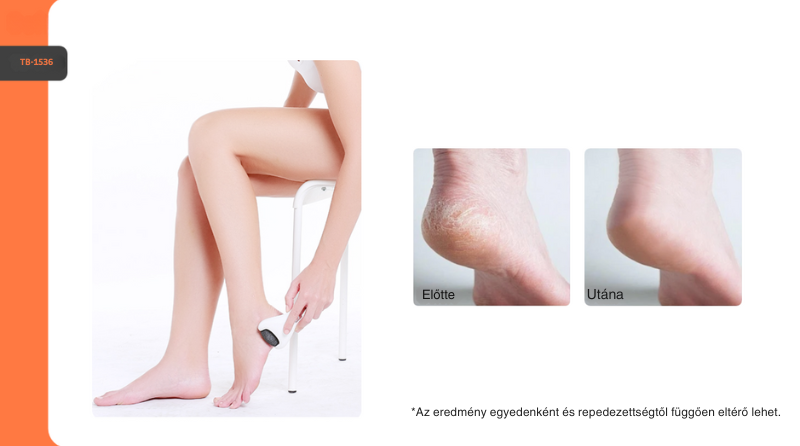 TOUCHBeauty™ Elektromos Pedikűr Készülék