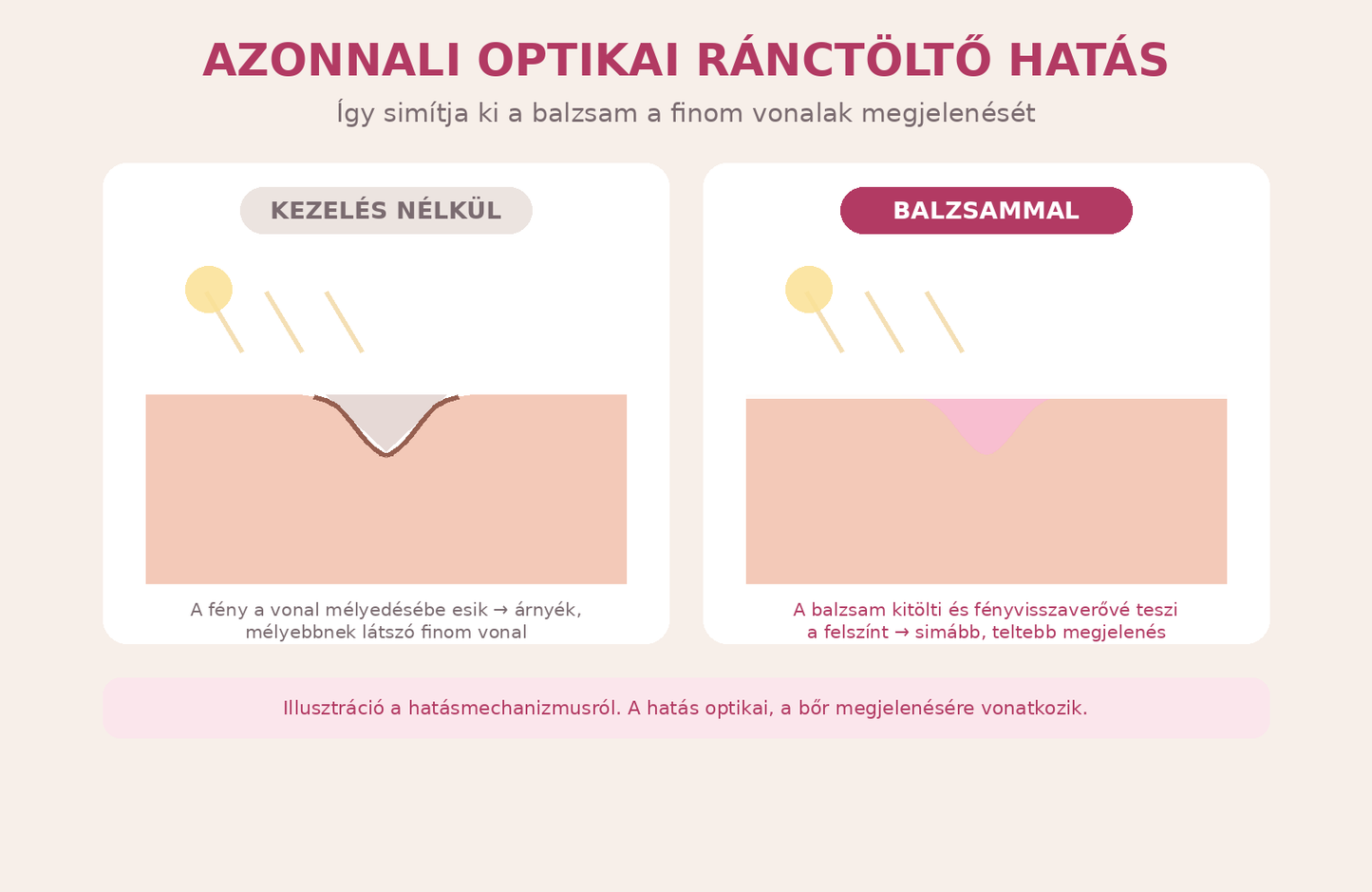 Azonnali optikai ránctöltő hatás illusztráció – a balzsam kitölti a finom vonalak felszínét