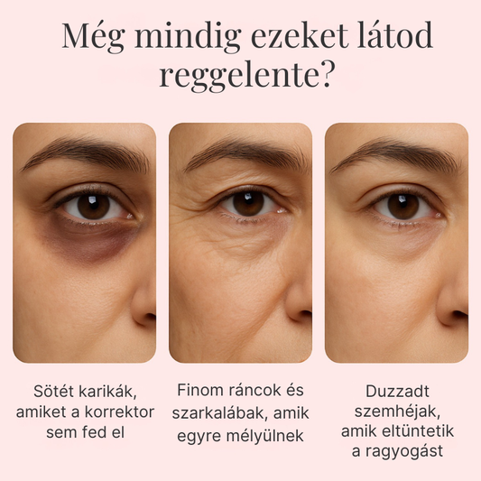 Sauvasine™ PDRN Peptid Lift & Repair Szemkörnyékápoló