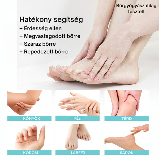 Lanthome™ Urea Krém – 40% Ureával és 2% Szalicilsavval a repedezett bőr ellen