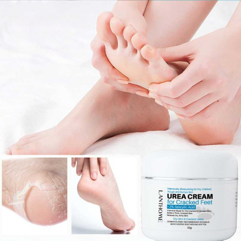 Lanthome™ Urea Krém – 40% Ureával és 2% Szalicilsavval a repedezett bőr ellen